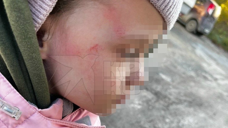 Вдавила ребенка в плитку: на Урале воспитательницу подозревают в избиении 5-летней девочки