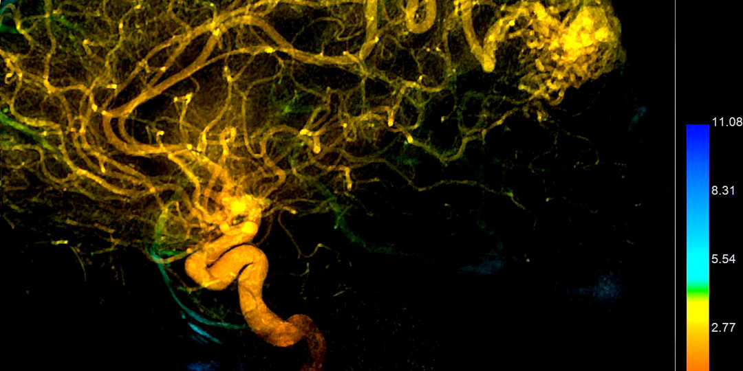 Единственный в РФ отечественный производитель ангиографических комплексов представил обновление в линейке