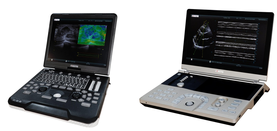 НИПК «Электрон» начал производство портативных УЗ-систем