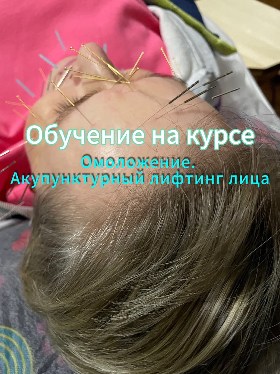 Вот эти иголочки делают чудеса!