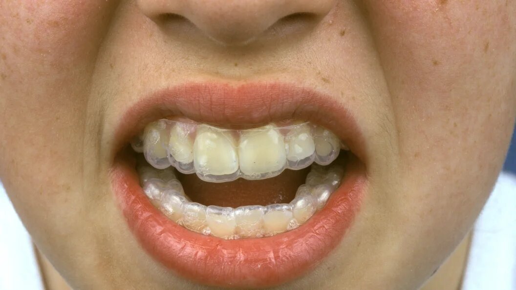    Фото: Alex Bartel/Globallookpress