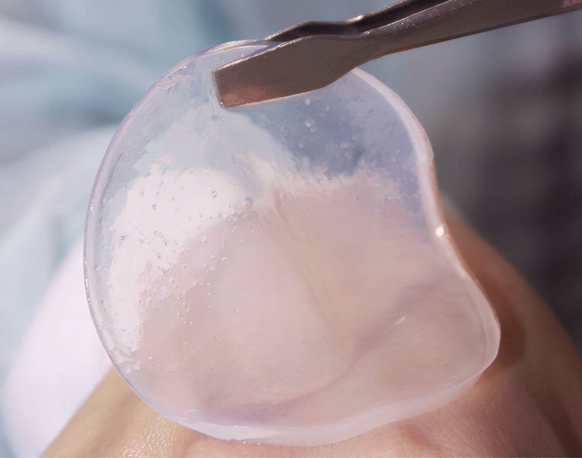 Раневое покрытие Novoskin из коллагена и ламинина