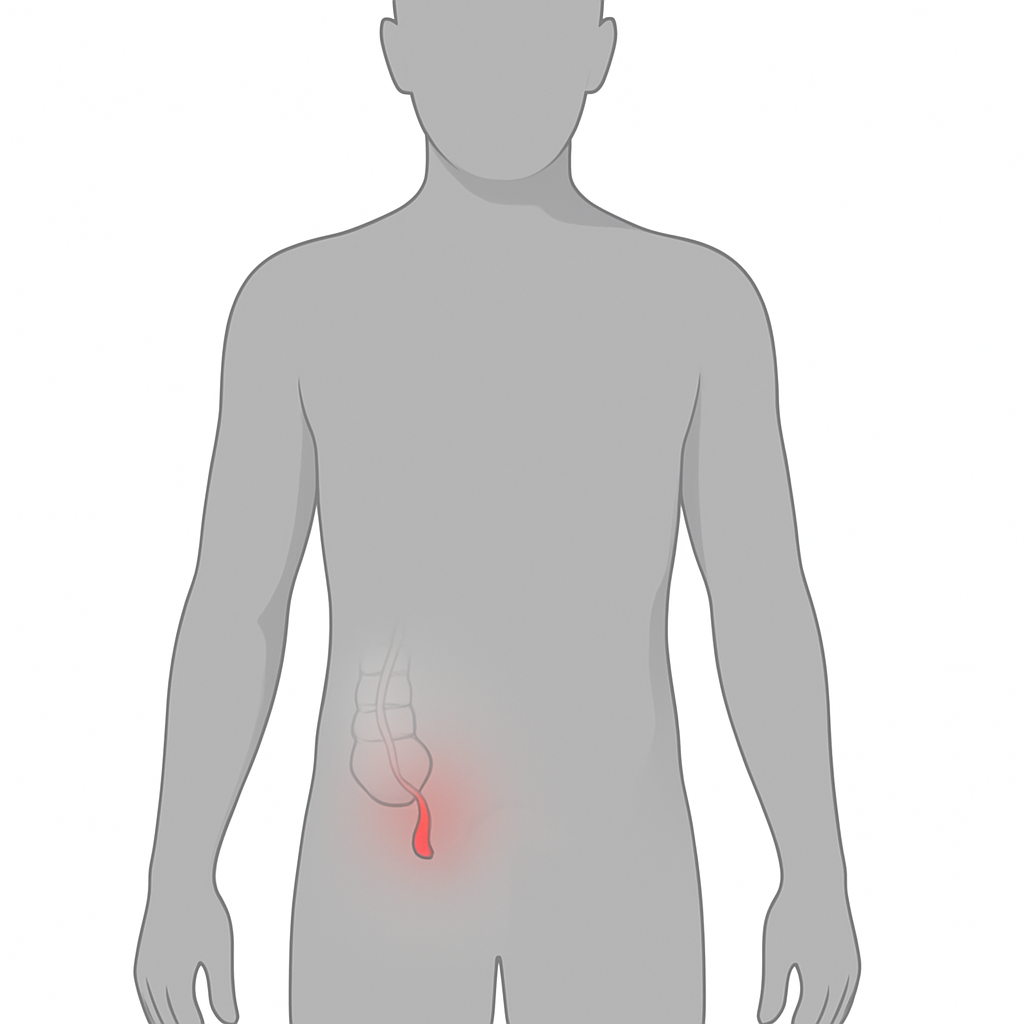 Развеиваем мифы про аппендицит