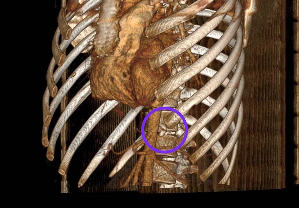 Фото: предоставлено пресс-службой РКБ Татарстана