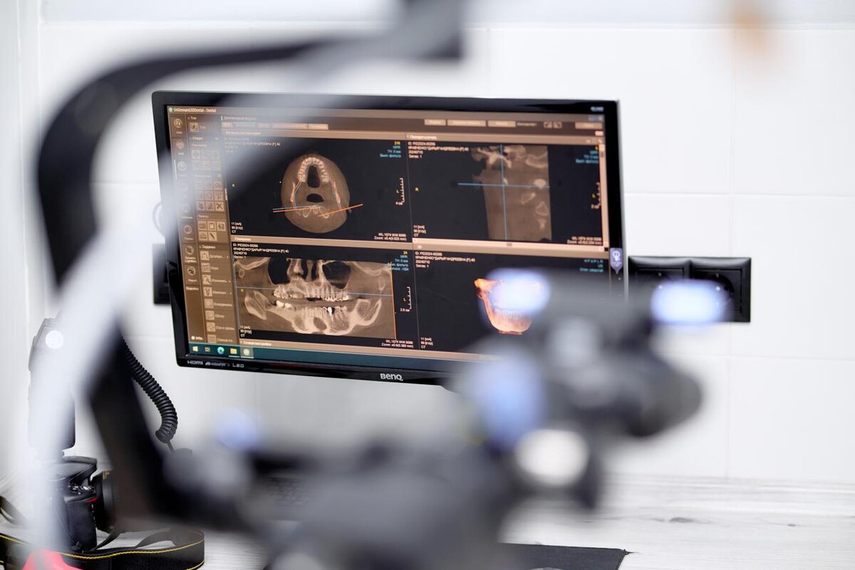 Кабинет стоматолога, современное оборудование, куратор лечения