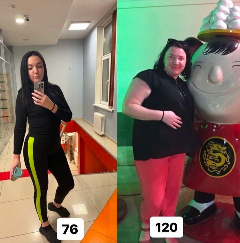 После бариатрической операции