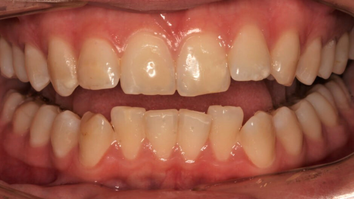 Фото пациентки до лечения.