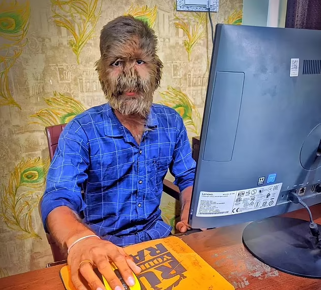 Лалит дома, руки покрыты пушком