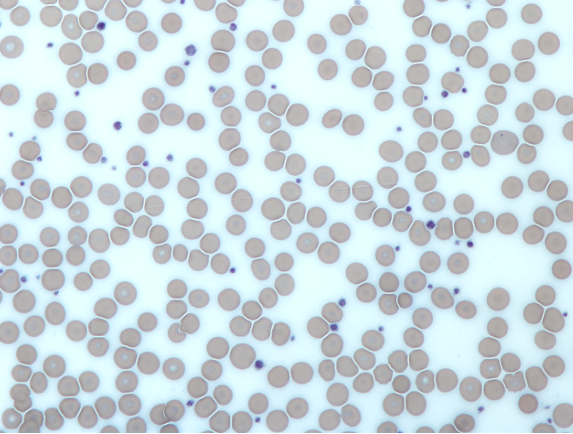 Тромбоциты под микроскопом