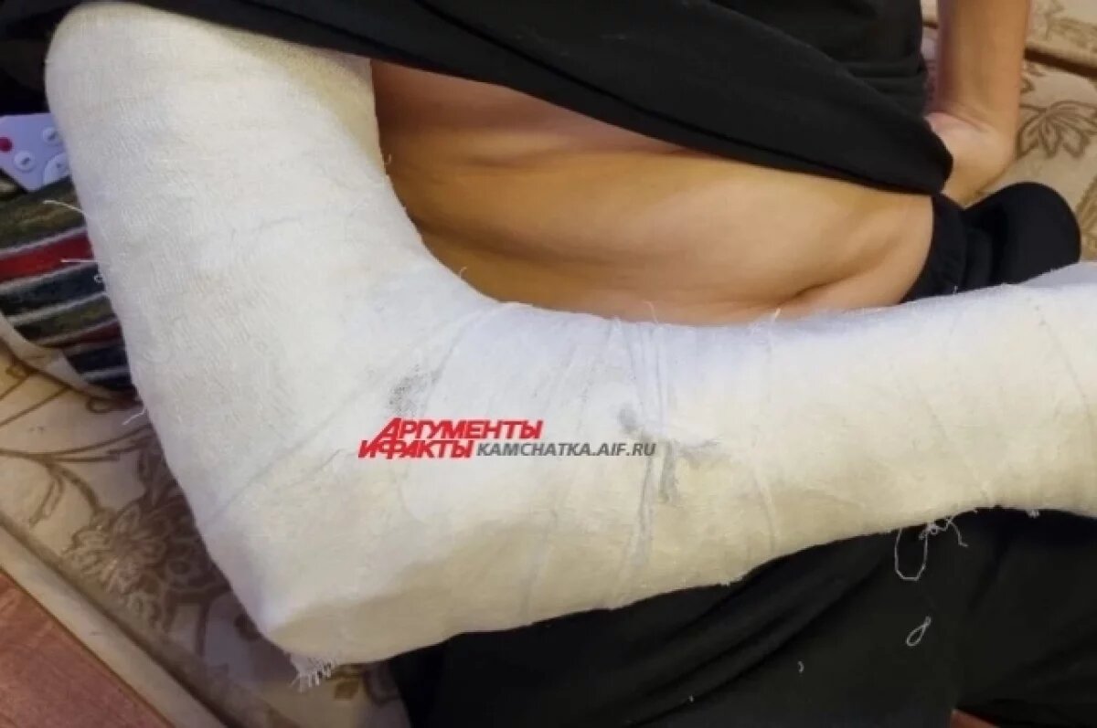    Подросток на Камчатке травмировал руку из-за ямы на дороге