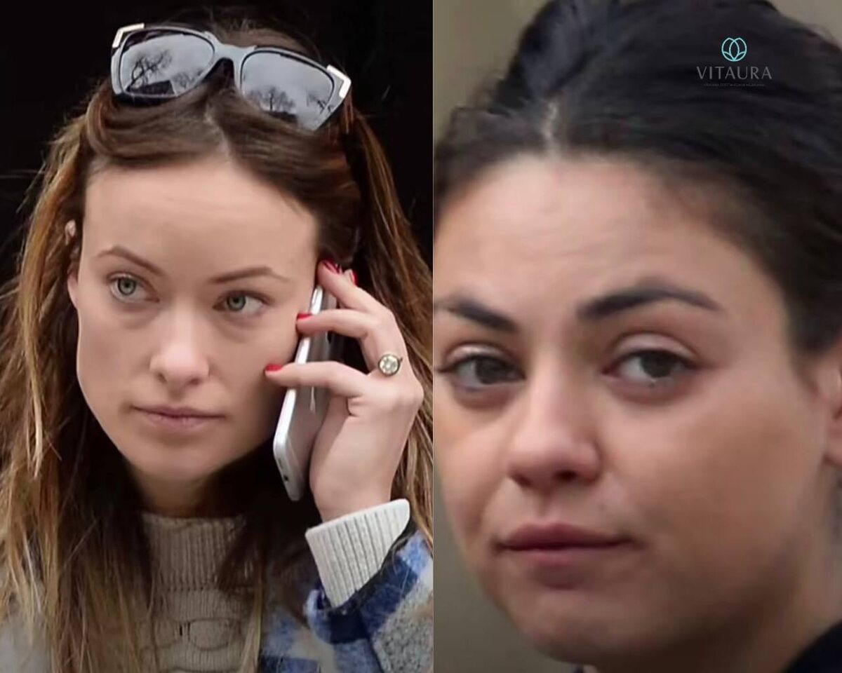 Лицо хронического стресса