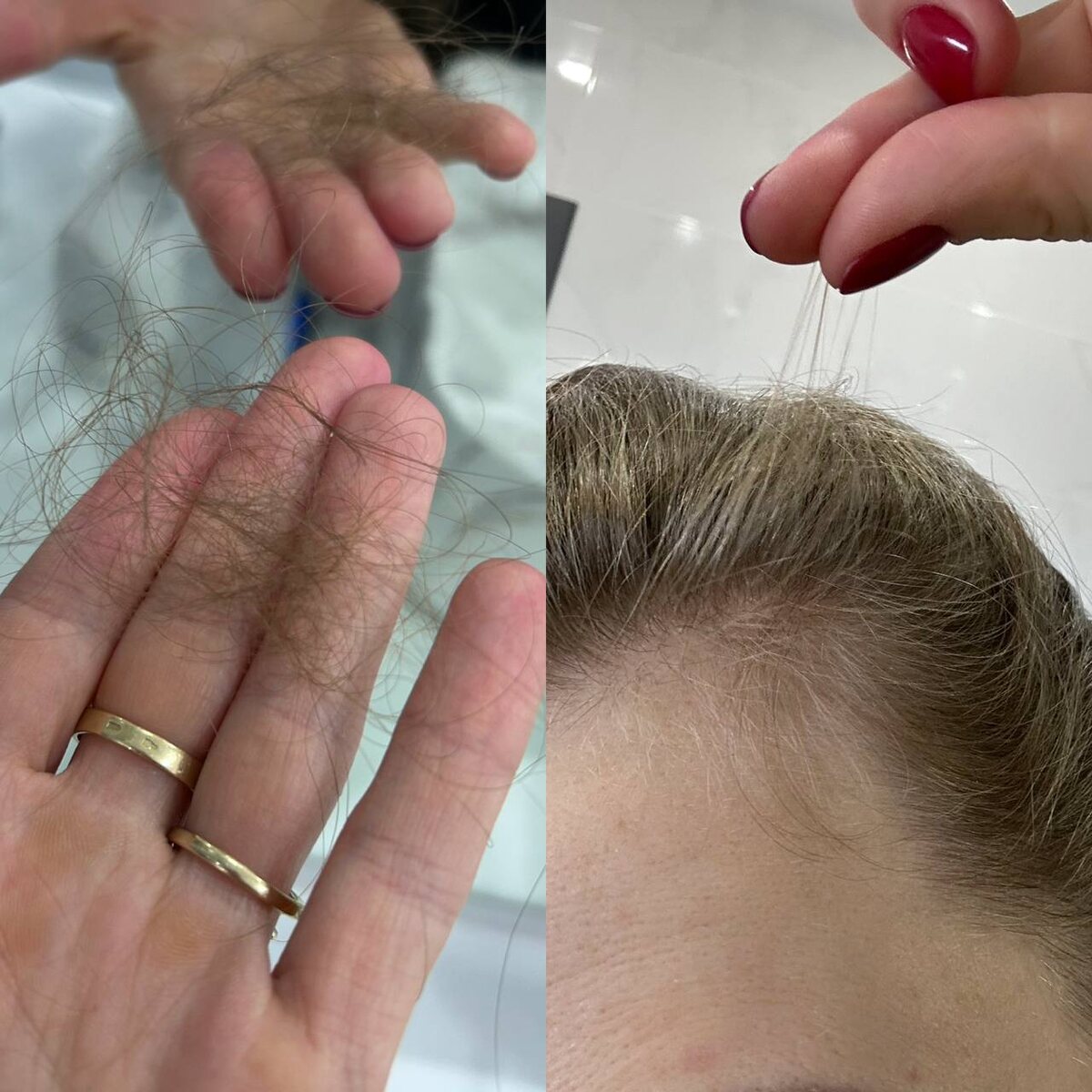 Мои фотографии после родов