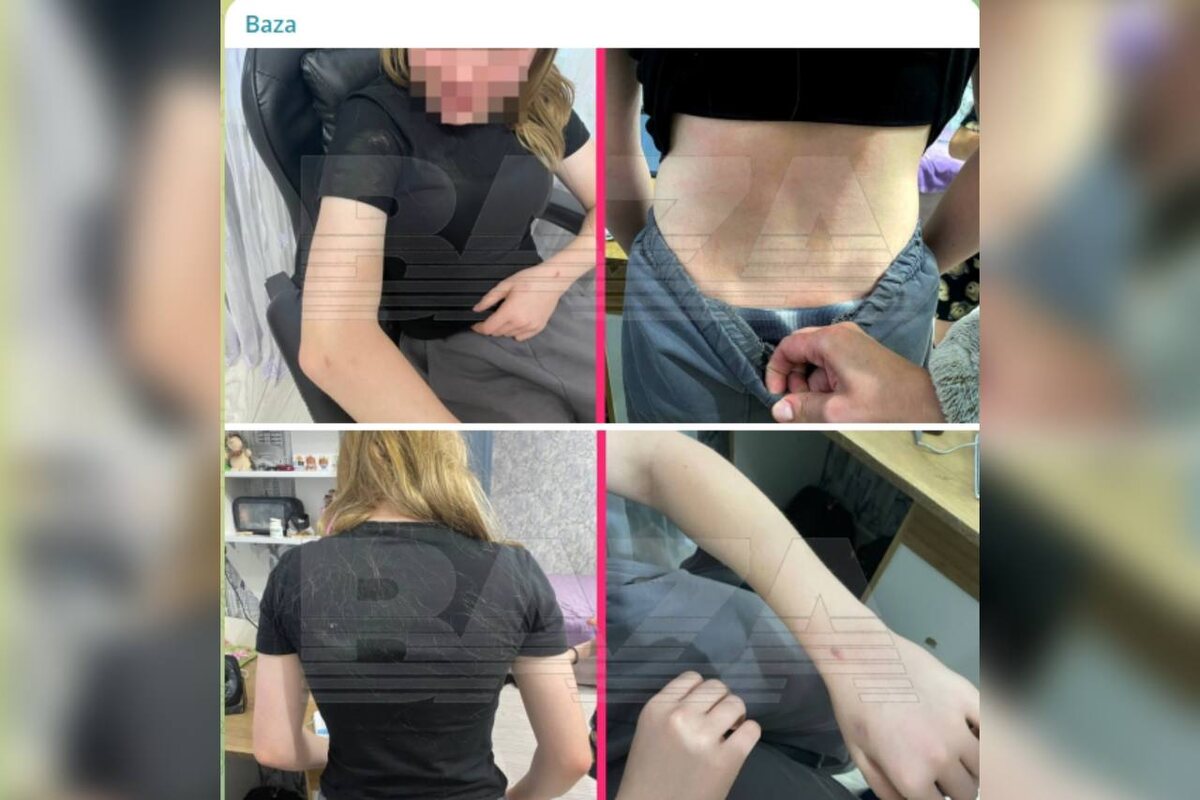    Издевались и били: Глава Следственного комитета России поручил возбудить уголовное дело по факту нападения подростков на школьницу в Орске