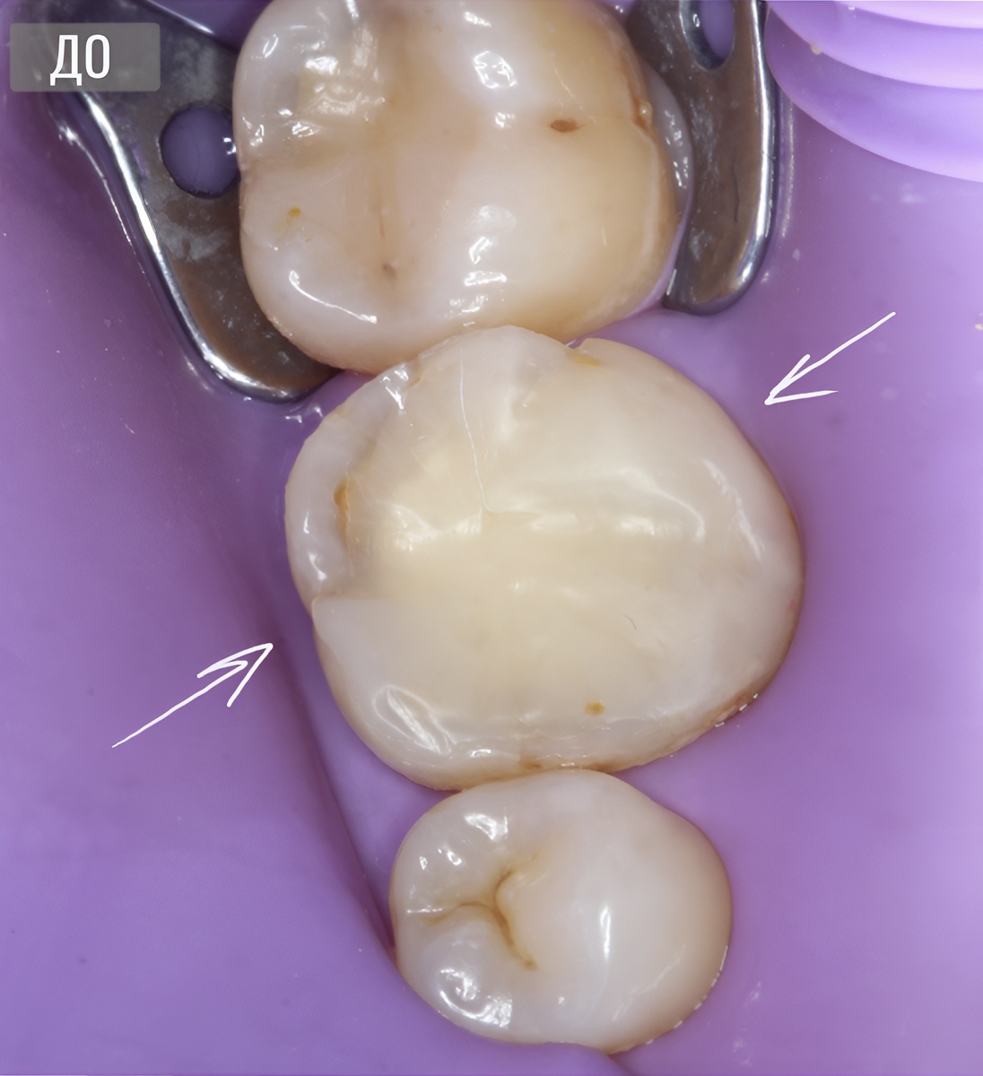 Зуб на момент обращения