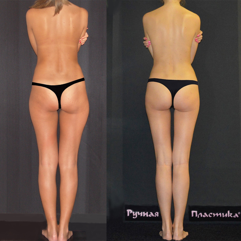 Центр Ручная Пластика. Москва.