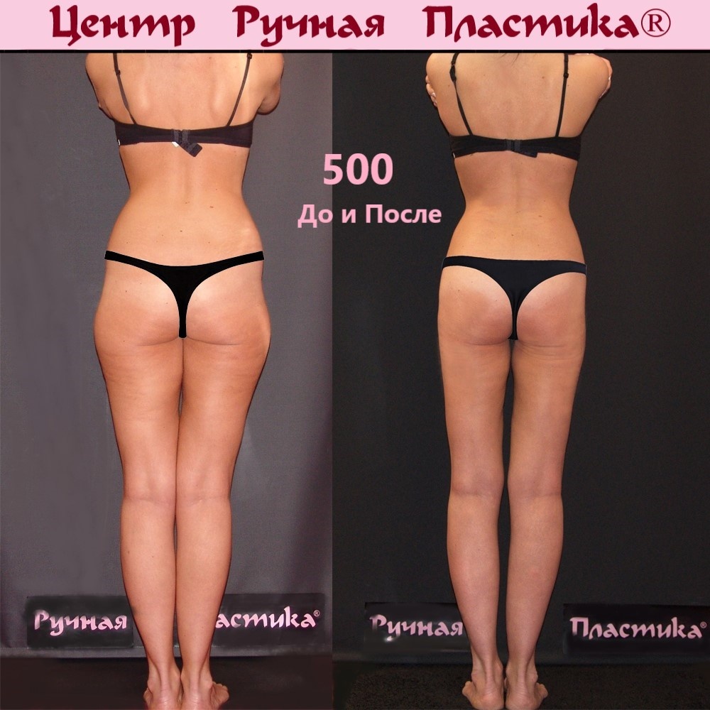 500 фото результатов на сайте центра Ручная Пластика. https://www.ruchnaya-plastika.ru/500-foto-rezultatov/fotogalereya-volynkin-yua-2010-po-nastvremya/