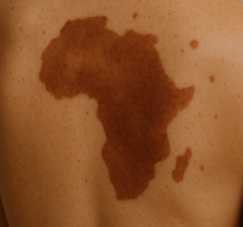 Это картинка ИИ, не фото