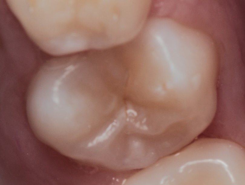 Бактериям такое нравится