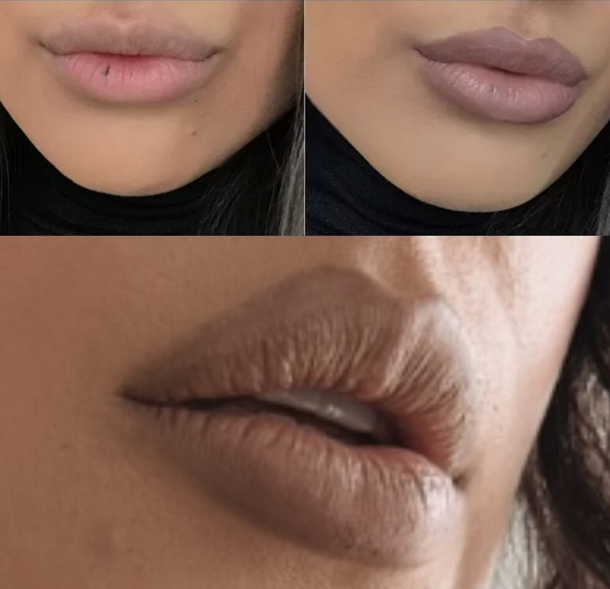 Amy-Rose Walker Lips 