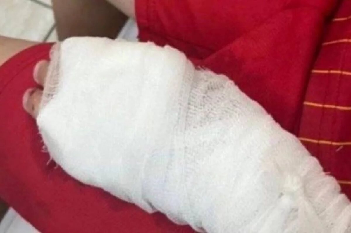    В Якутии на хозяина собаки, укусившей восьмилетнего мальчика, подали в суд