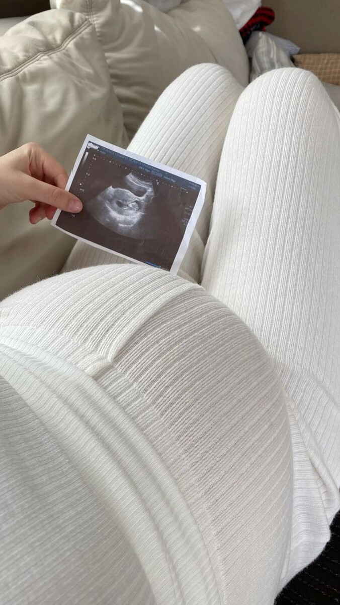 Беременная девушка