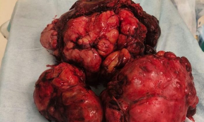 Фото пресс-центра НМИЦ им. ак. Е.Н. Мешалкина.