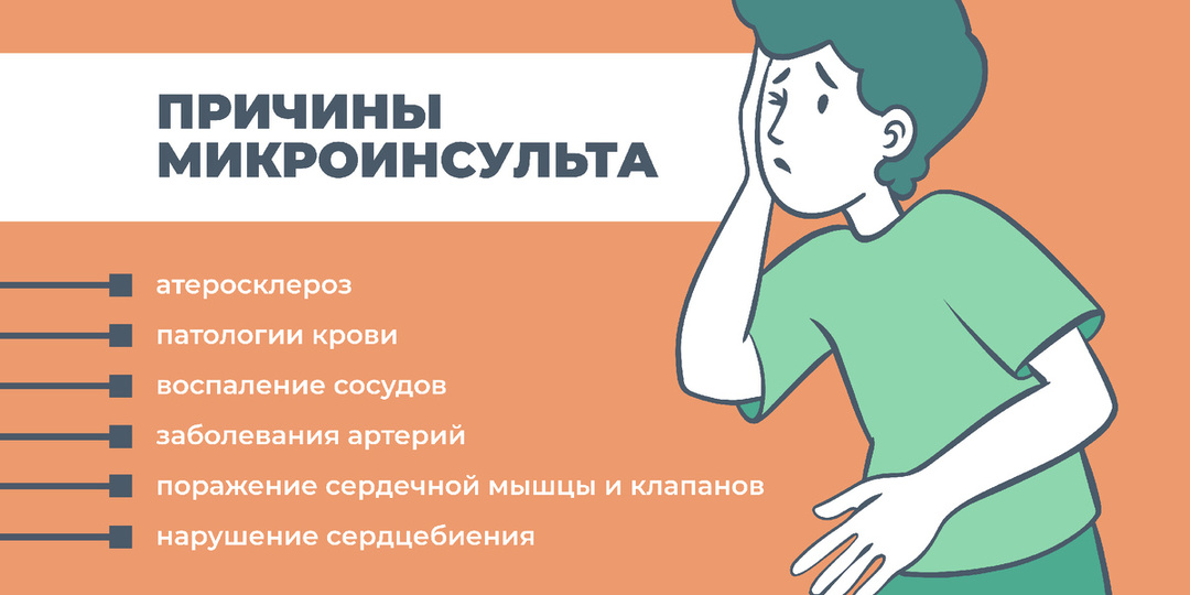 Мини-удар»: как распознать микроинсульт, пока не стало слишком поздно