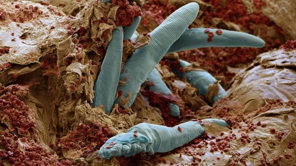 Demodex folliculorum. Изображение получено с помощью сканирующего электронного микроскопа.