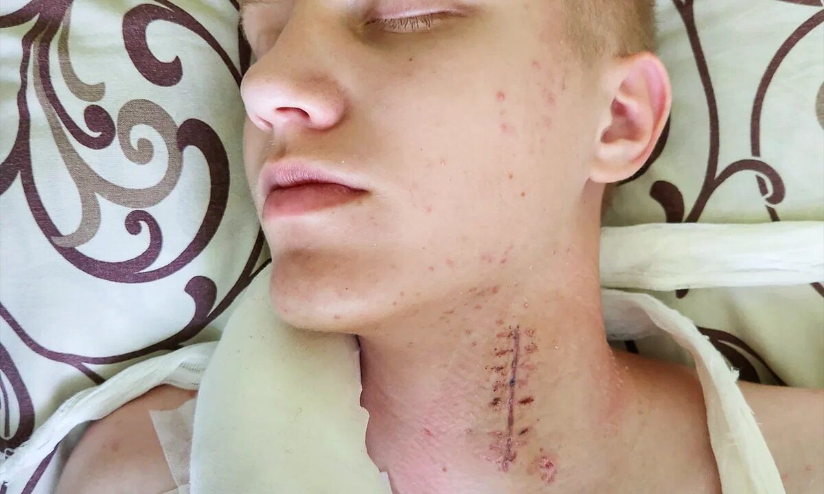 Денис Скороход, подопечный фонда «Алёша»