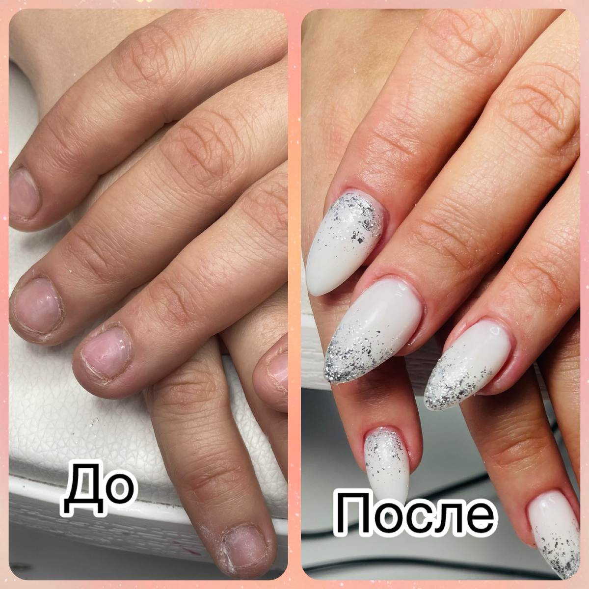 Преображение ногтей «грызунчика» (фото из личного архива)