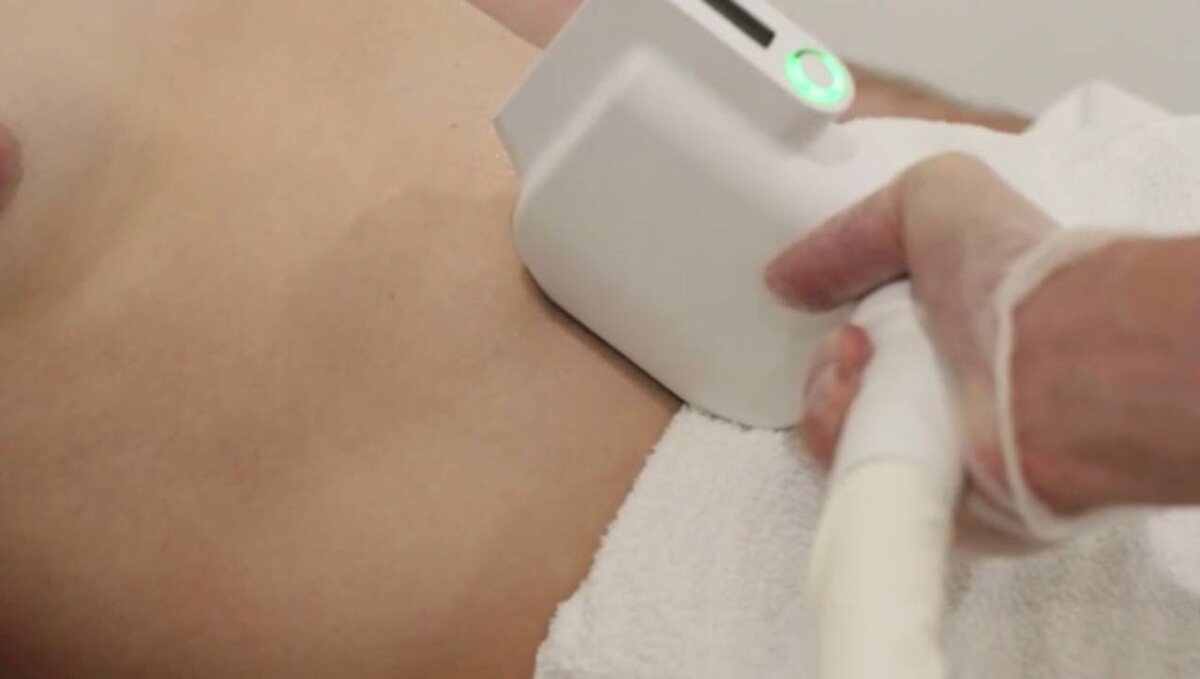 Фотоэпиляция и фотоомоложение - обучение в Центре обучения Scopula