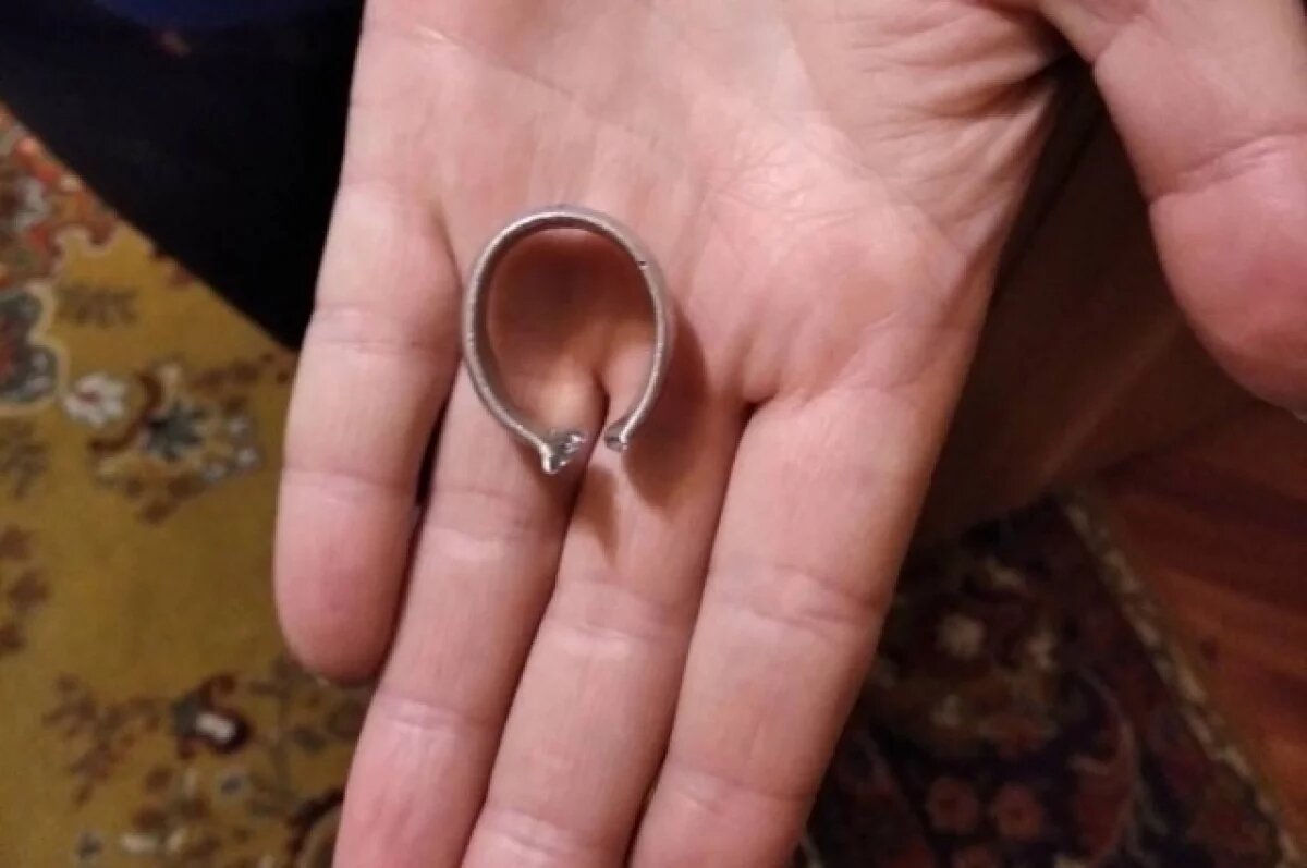    Спасатели в Бурятии сняли кольцо с опухшего пальца жительницы Сотниково