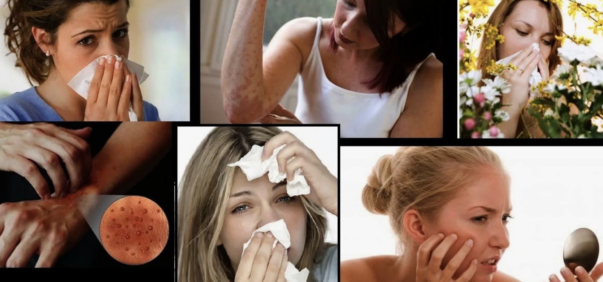 Можно ли вылечить аллергию у взрослого и ребенка ?