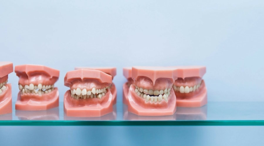 Что такое прикус?