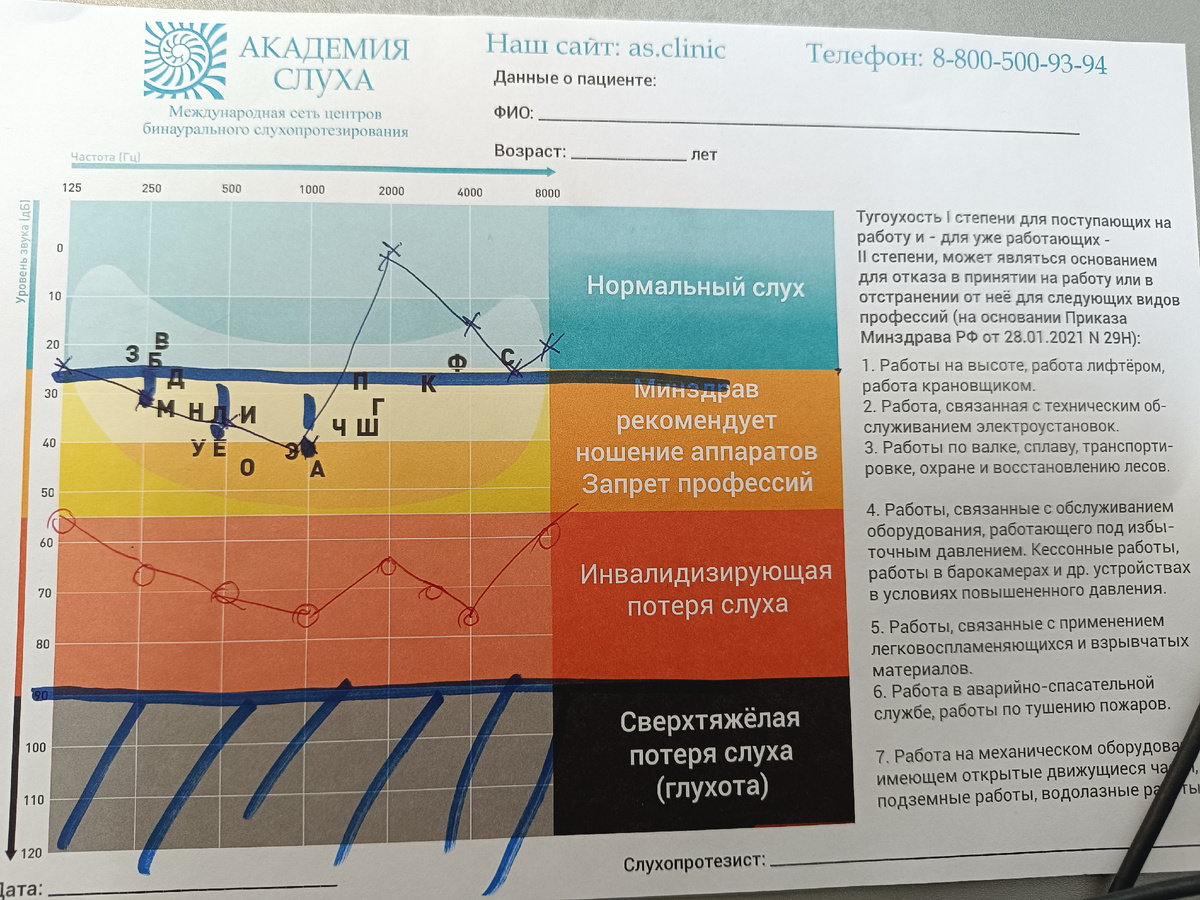 Синим обозначено левое ухо, красным - правое