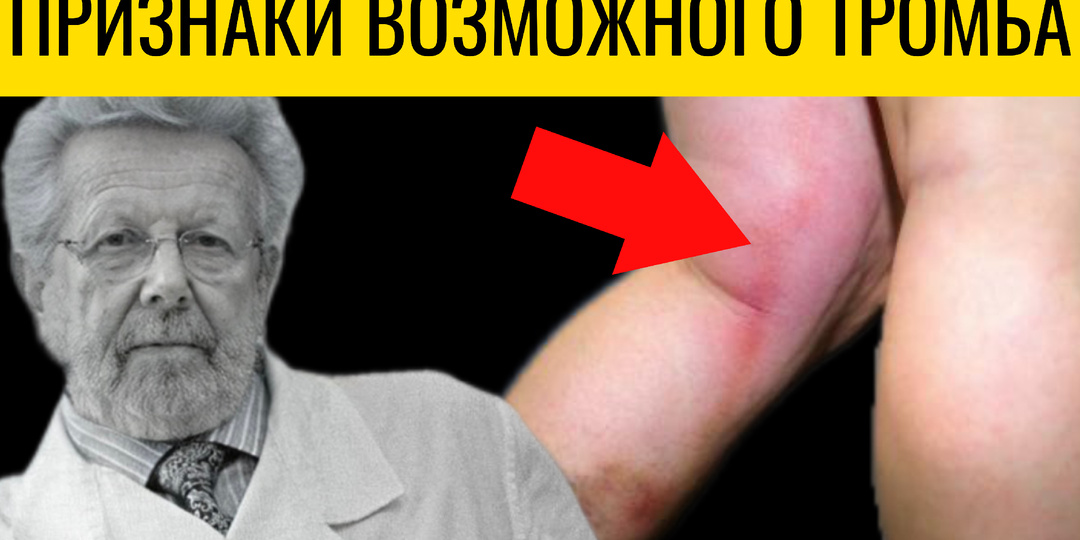 Кардиологи о сигналах тела: 9 признаков возможного тромба