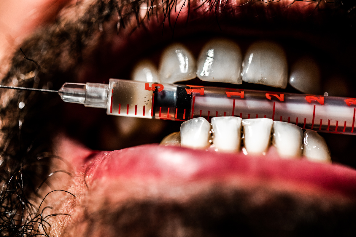 Как наркотики разрушают зубы и здоровье полости рта (источник изображения: freepik.com)