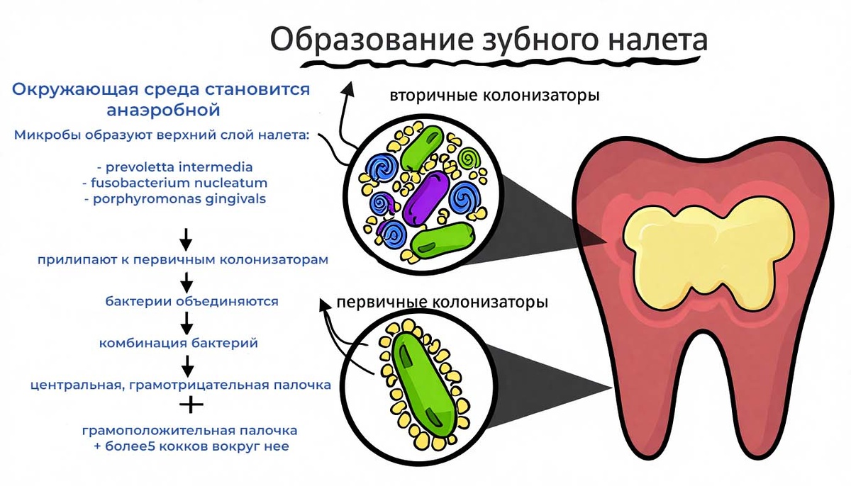 Зубной налёт – главный враг зубных имплантов. 