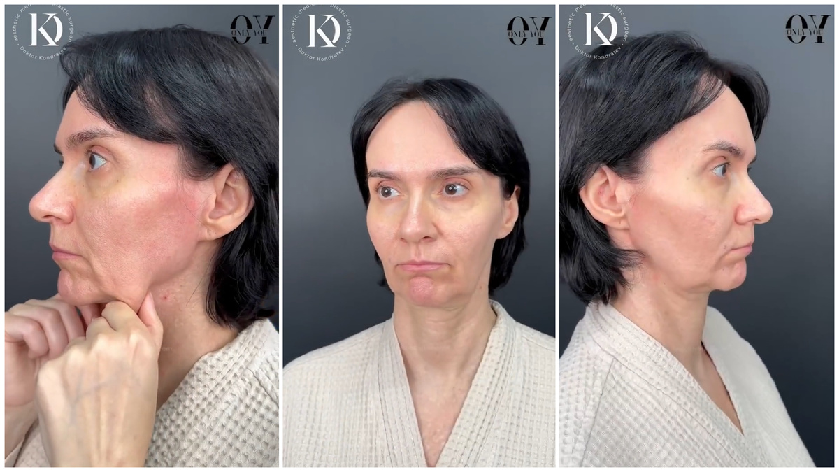 день операции