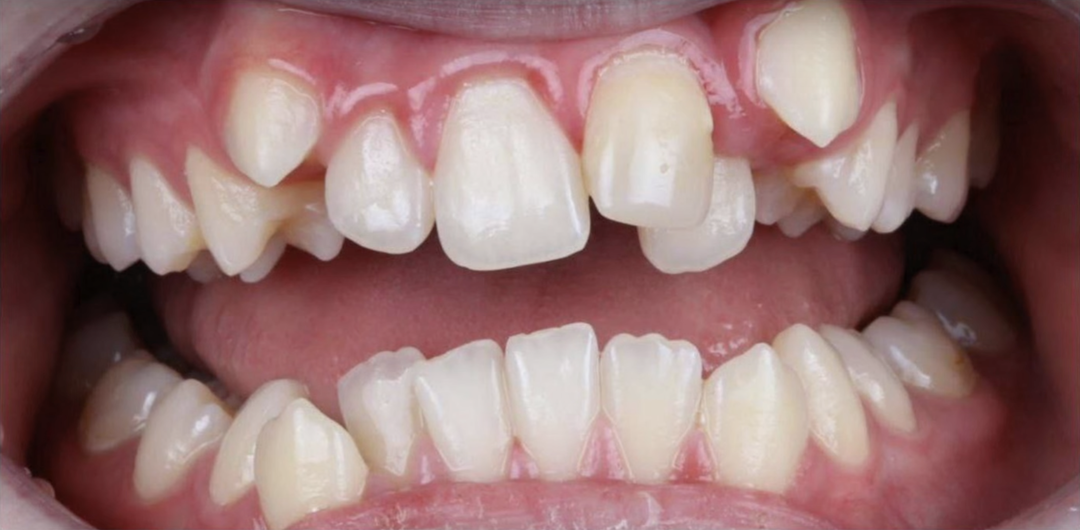 5 самых распространённых ошибок ортодонтов, которые могут навредить Вашему здоровью