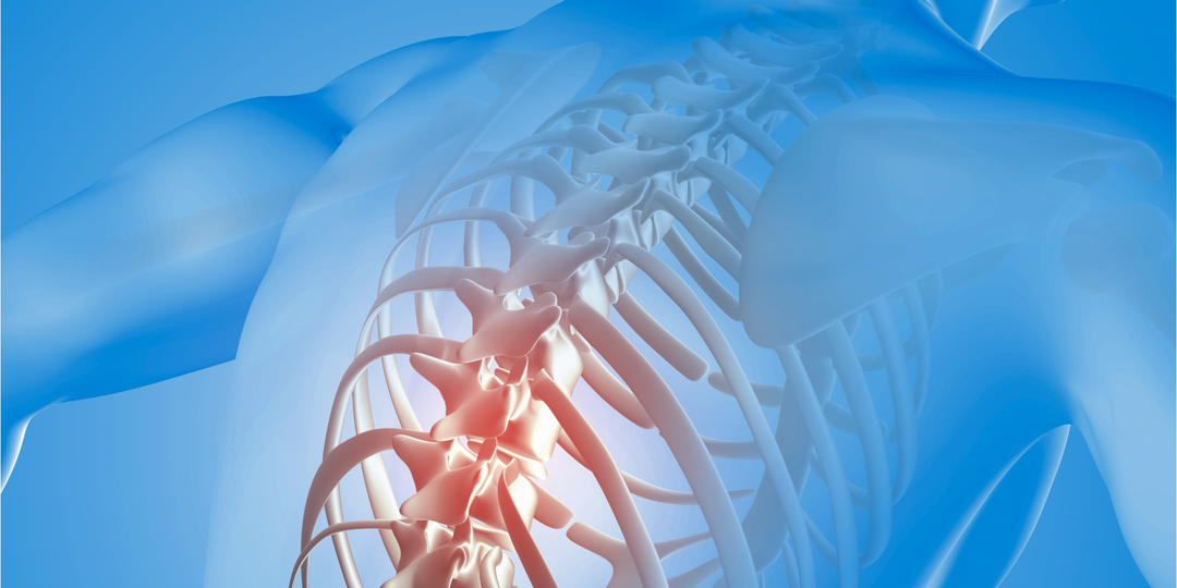 Чек-лист: как понять, что у вас грыжа позвоночника?