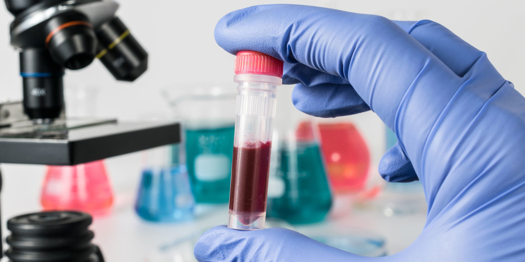 Общий анализ крови: как прочитать «язык цифр» и понять, что ваше тело пытается сказать