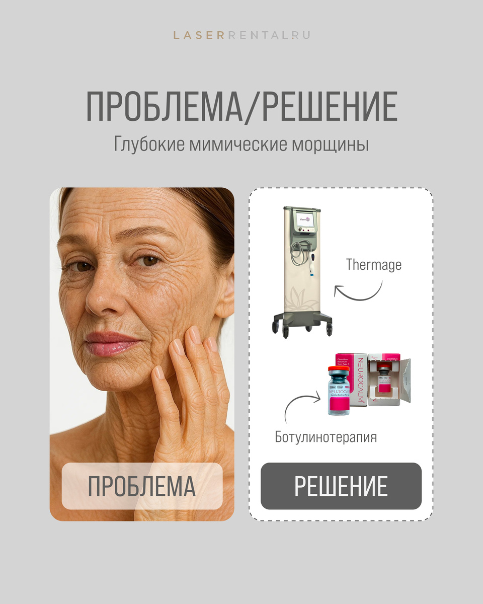 Глубокие мимические морщины
