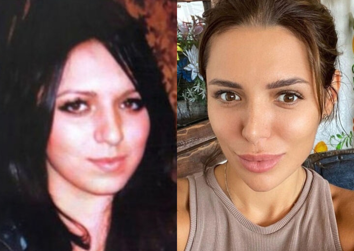 лицо до\после, фото из интернета