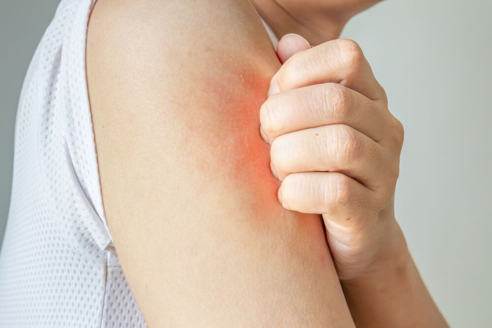 Раздражение на коже