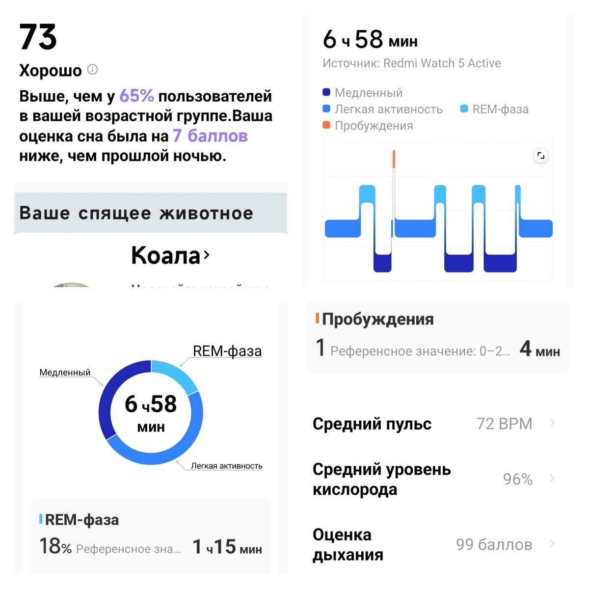 Анализ сна от приложения Mi Fitness. Снимок экрана телефона автора.