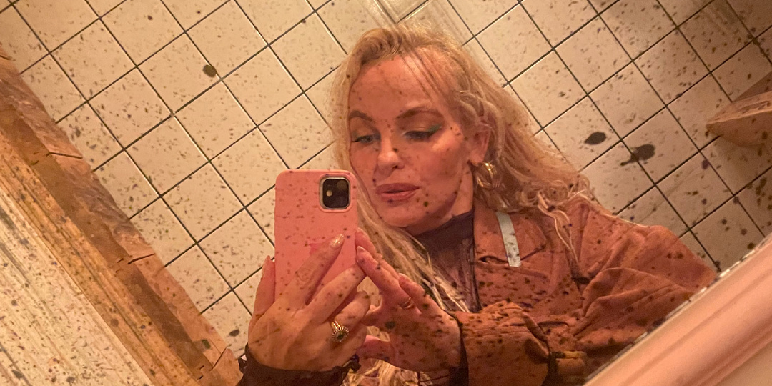 Остеохондроз – великий имитатор: Как отличить боль в сердце от хондроза и почему может болеть все что угодно