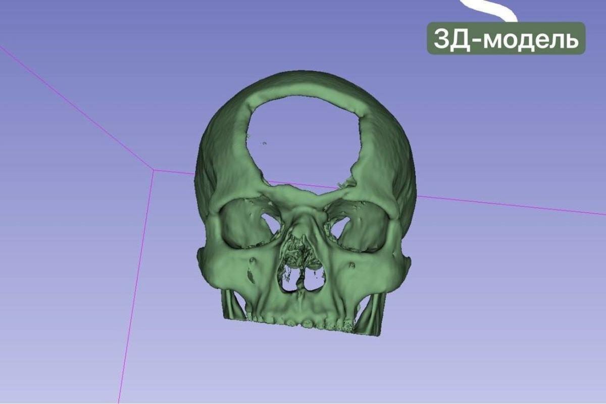    Фото: Республиканская клиническая больница Татарстана, источник: realnoevremya.ru