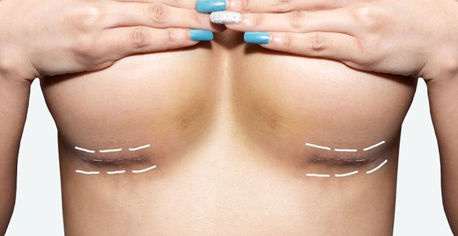 Шрамы после операции чем мазать и что делать? Патологический рубец