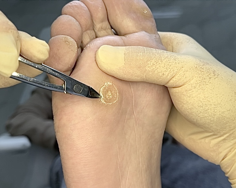 Диаметр кожного уплотнения 13 мм